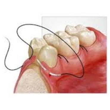 dentmega-tedavi
